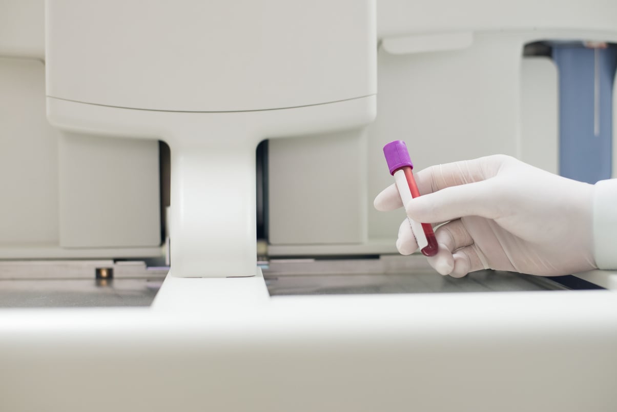 Blood test for Complete Blood Count. CBC medical science backgro